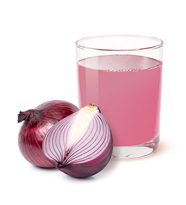  onion juice for treating dandruff  