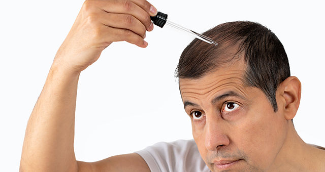 A Simple Guide To Reversing Baldness & Male Pattern Hair Loss